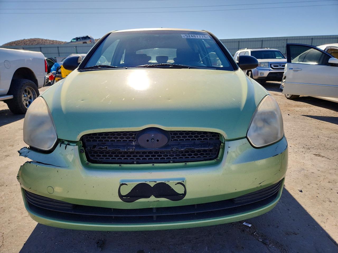 2009 Hyundai Accent VIN KMHCM36C49U122110 photo 5